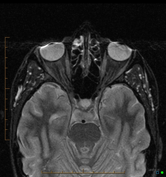 What Is Medical Imaging?